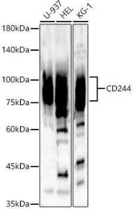 Western blot analysis of various lysates, using Anti-2B4 Antibody (A11500) at 1:1,000 dilution The secondary antibody was Goat Anti-Rabbit IgG H&L Antibody (HRP) at 1:10,000 dilution Lysates/proteins were present at 25 µg per lane