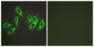 Immunofluorescence analysis of HepG2 cells using Anti-Heparin Cofactor II Antibody. The right hand panel represents a negative control, where the antibody was pre-incubated with the immunising peptide