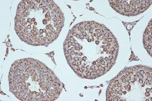 Immunohistochemistry analysis of paraffin-embedded rat testis using Anti-Smac / Diablo Antibody [ARC1340] (A305474) at a dilution of 1:100 (40x lens). Perform microwave antigen retrieval with 10 mM Tris/EDTA buffer pH 9.0 before commencing with IHC staining protocol.