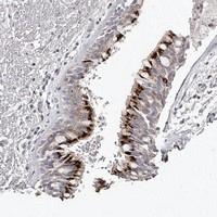 Anti-SLC35D3 Rabbit Polyclonal Antibody