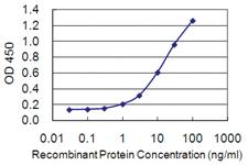 Anti-DAB2IP Mouse Monoclonal Antibody [clone: 8C10]