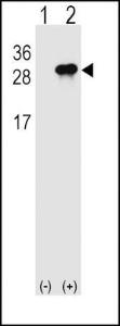 Anti-IFNL3 Rabbit Polyclonal Antibody (FITC (Fluorescein Isothiocyanate))