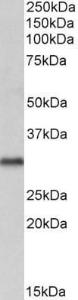 Anti-VDAC2 Antibody (A84017) (1 µg/ml) staining of Human Brain (Cerebellum) lysate (35 µg protein in RIPA buffer). Detected by chemiluminescence