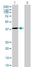 Anti-DNTTIP1 Mouse Polyclonal Antibody