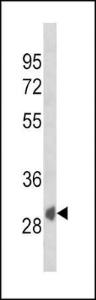 Anti-SFRP1 Rabbit Polyclonal Antibody (AP (Alkaline Phosphatase))