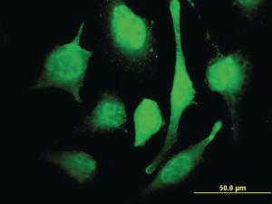 Anti-MARCH7 Mouse Monoclonal Antibody [clone: 2B9]