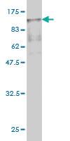 Anti-RDX Mouse Monoclonal Antibody [clone: 1F6]