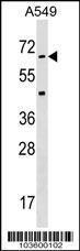 Anti-STK35 Rabbit Polyclonal Antibody (PE (Phycoerythrin))