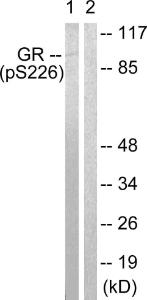 Western blot analysis of lysates from Jurkat cells treated with EGF 200 ng/ml 15' using Anti-GR (phospho Ser226) Antibody. The right hand lane represents a negative control, where the Antibody is blocked by the immunising peptide