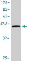 Anti-PLA2G16 Mouse Monoclonal Antibody [clone: 1B10-2D9]