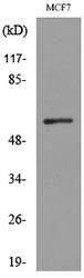 Anti-ACVRL1 Rabbit Polyclonal Antibody