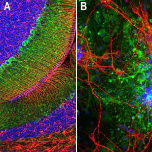 Anti-Aldolase C Mouse Monoclonal Antibody [clone: 4A9]