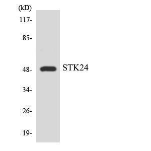 Western blot analysis of the lysates from COLO205 cells using Anti-STK24 Antibody