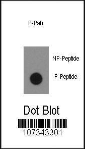 Anti-ABL1 Rabbit Polyclonal Antibody (AP (Alkaline Phosphatase))