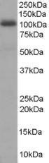 Antibody anti-AKAP8 100 µg