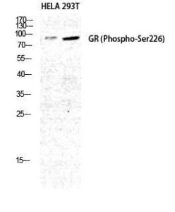 Western blot analysis of HELA 293T cells using Anti-GR (phospho Ser226) Antibody