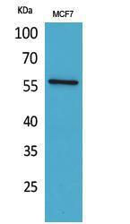 Anti-ACVRL1 Rabbit Polyclonal Antibody