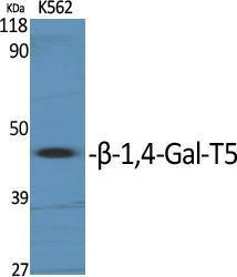 Western blot analysis of various cells using Anti-B4GALT5 Antibody