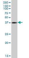 Anti-RHOXF2 Mouse Polyclonal Antibody