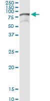 Anti-TIAM2 Polyclonal Antibody Pair