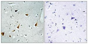 Immunohistochemical analysis of paraffin-embedded human brain tissue using Anti-STAT6 Antibody The right hand panel represents a negative control, where the antibody was pre-incubated with the immunising peptide