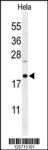 Anti-CLEC2B Rabbit Polyclonal Antibody