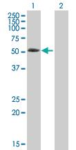 Anti-ABLIM3 Mouse Polyclonal Antibody