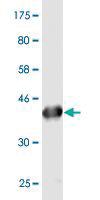 Anti-PLA2G16 Mouse Monoclonal Antibody [clone: 4C4-2A11]