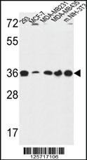 Anti-TOR1B Rabbit Polyclonal Antibody