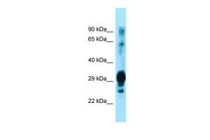 Anti-GPM6A Rabbit Polyclonal Antibody