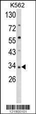 Anti-SFRP5 Rabbit Polyclonal Antibody (APC (Allophycocyanin))