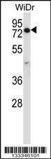 Anti-CCDC22 Rabbit Polyclonal Antibody (PE (Phycoerythrin))