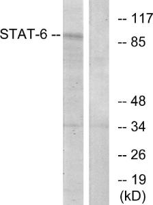 Western blot analysis of lysates from HeLa cells using Anti-STAT6 Antibody The right hand lane represents a negative control, where the antibody is blocked by the immunising peptide