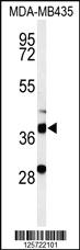 Anti-HIPK1 Rabbit Polyclonal Antibody