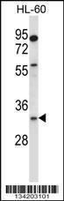 Anti-EGLN3 Rabbit Polyclonal Antibody (AP (Alkaline Phosphatase))