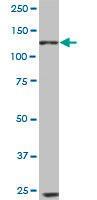 Anti-EPHB6 Mouse Monoclonal Antibody [clone: 5D8]