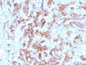 Immunohistochemical analysis of formalin-fixed, paraffin-embedded human adrenal using Anti-TIM3 Antibody [TIM3/3113]