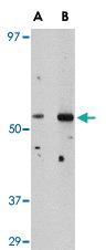 Anti-PLXDC2 Rabbit Polyclonal Antibody