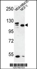 Anti-SEC24C Rabbit Polyclonal Antibody