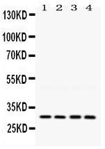 Anti-LOX Rabbit Polyclonal Antibody