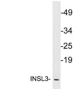 Western blot analysis of lysates from MCF7 cells using Anti-INSL3 Antibody