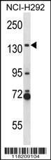 Anti-NOS2 Rabbit Polyclonal Antibody (FITC (Fluorescein Isothiocyanate))