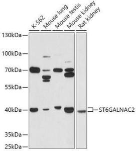 Western blot analysis of extracts of various cell lines, using Anti-ST6GALNAC2 Antibody (A305476) at 1:1,000 dilution. The secondary antibody was Goat Anti-Rabbit IgG H&L Antibody (HRP) at 1:10,000 dilution.