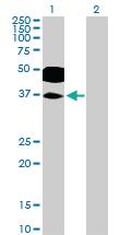 Anti-RHOXF2 Mouse Polyclonal Antibody