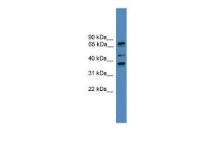 Anti-BBS5 Rabbit Polyclonal Antibody