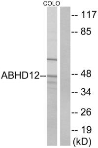 Western blot analysis of lysates from COLO cells using Anti-ABHD12 Antibody. The right hand lane represents a negative control, where the antibody is blocked by the immunising peptide