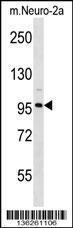 Anti-CLCN2 Rabbit Polyclonal Antibody