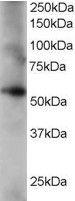 Anti-CORO1C Antibody (A84023) staining (0.2 µg/ml) of human lung lysate (RIPA buffer, 35 µg total protein per lane). Primary incubated for 1 hour. Detected by western blot using chemiluminescence