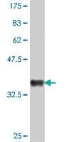 Anti-FUBP1 Mouse Polyclonal Antibody