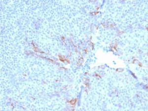 Immunohistochemical analysis of formalin-fixed, paraffin-embedded human tonsil using Anti-TIM3 Antibody [TIM3/3113]